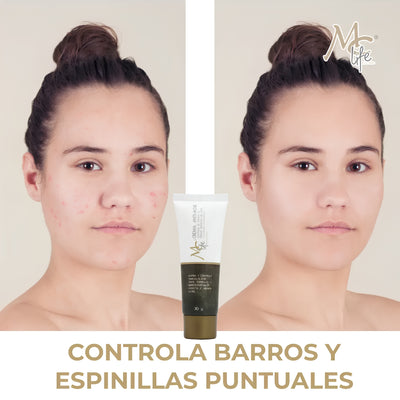 CREMA MC LIFE ANTI-ACNE 30 GRS
