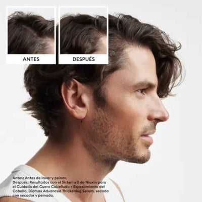 SHAMPOO NIOXIN 2 PURIFICANTE 1000ML